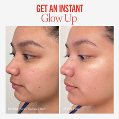 First Aid Beauty Radiance Pads glycolic and lactic acids for gentle exfoliation.