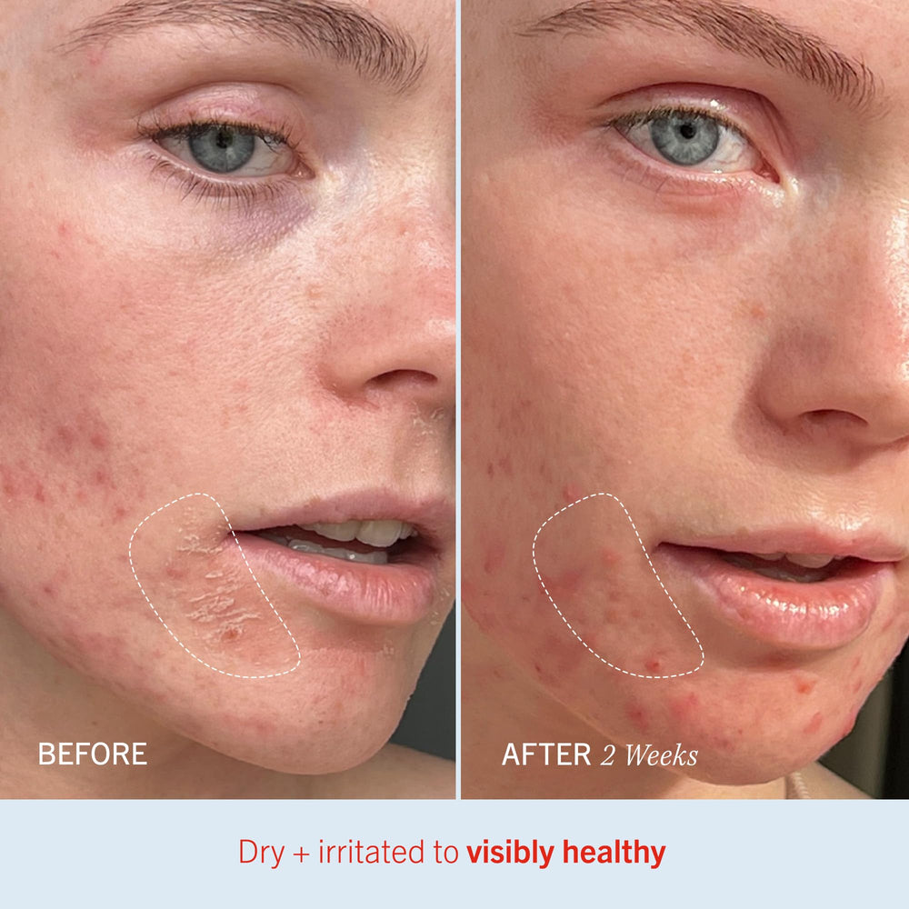 First Aid Beauty Ultra Repair Cream face application for daily moisturizing