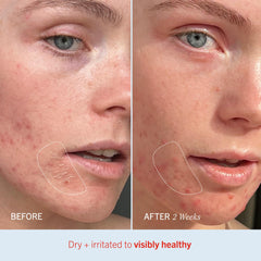 First Aid Beauty Ultra Repair Cream face application for daily moisturizing