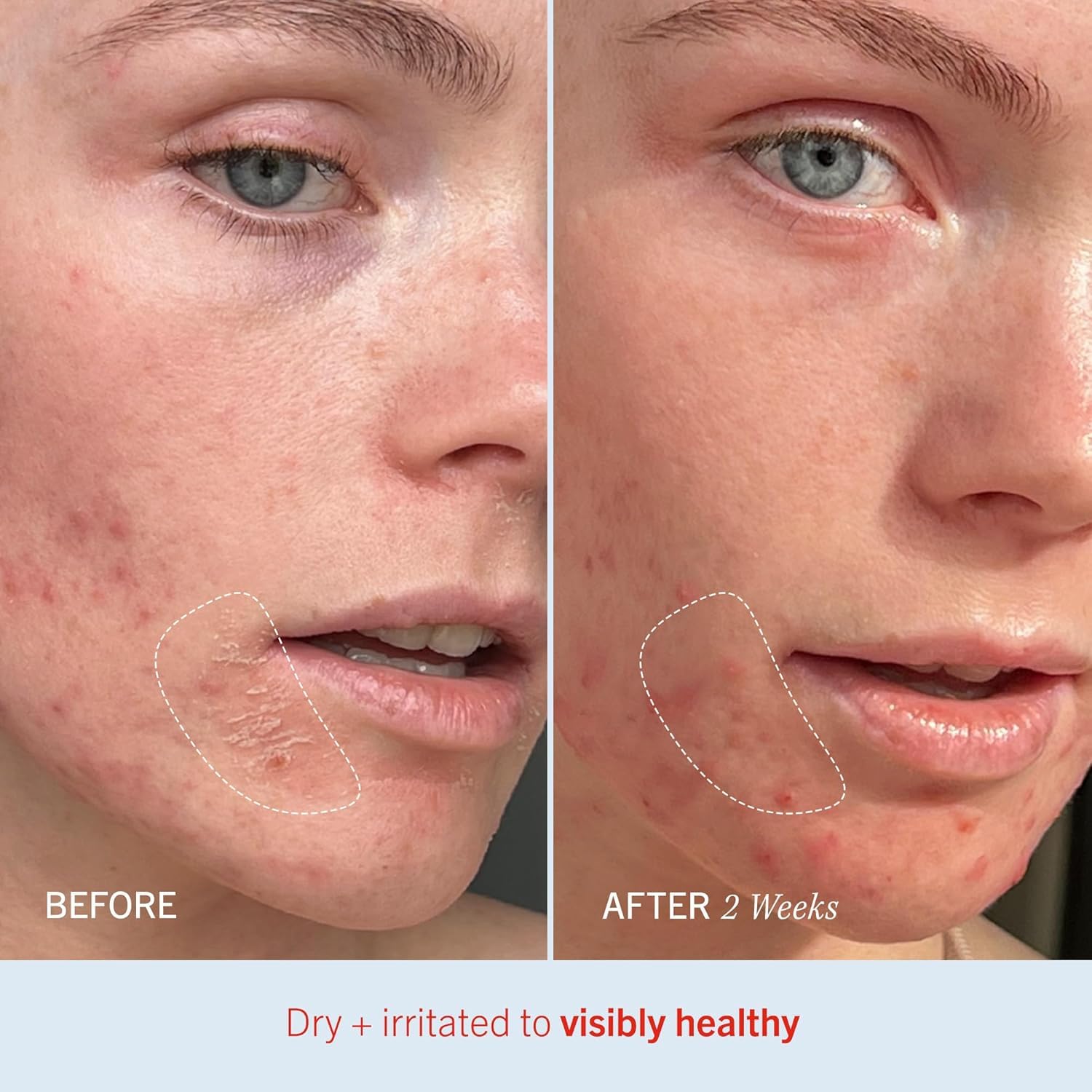 First Aid Beauty Ultra Repair Cream vanilla cinnamon scent enhances routine