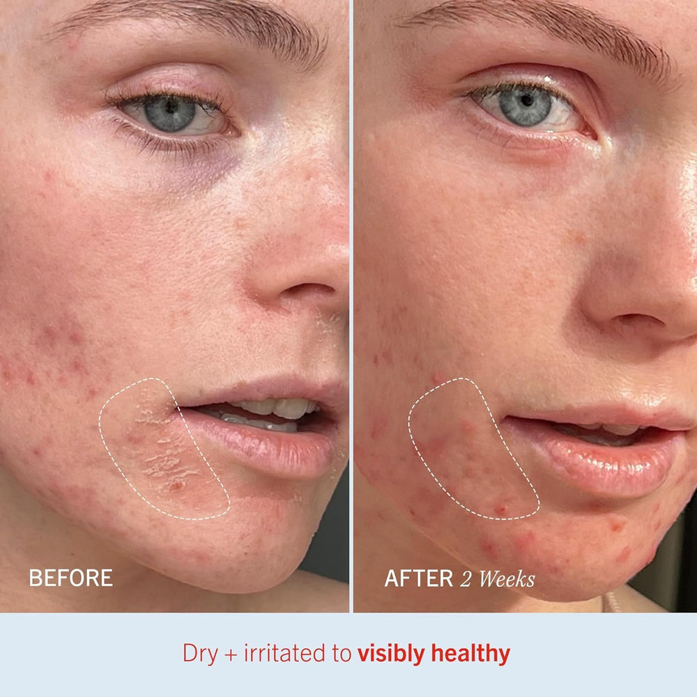 First Aid Beauty Ultra Repair Cream vanilla cinnamon scent enhances routine