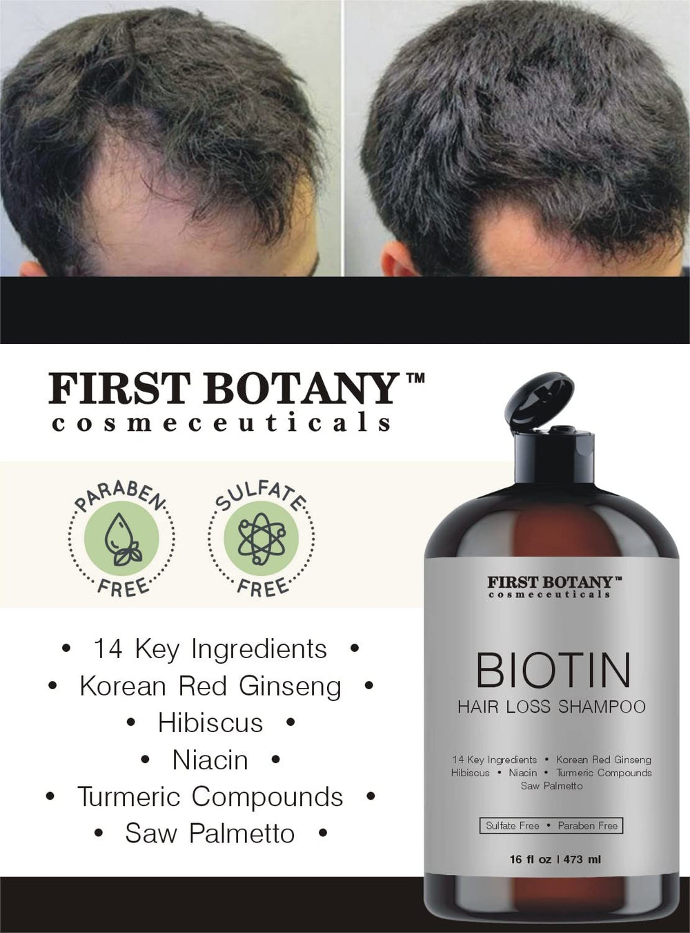 First Botany Cosmeceuticals label closeup noting DHT blockers and natural extracts