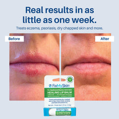FixMySkin travel-friendly lip balm in pocket for everyday protection.