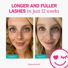 Early progress seen with FLASHSERUM in about two weeks for some users.