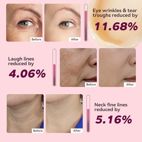 Fleur Luxxe Calcium Multi Balm Eyes: smooths delicate eye area.