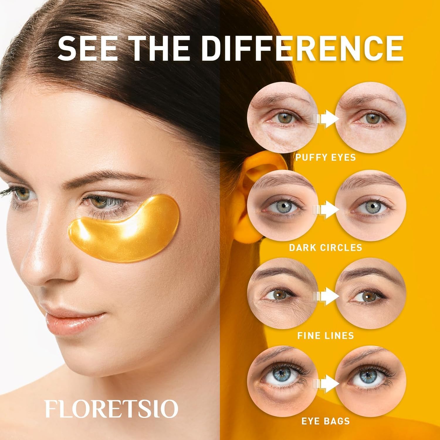Floretsio under-eye patches reduce dark circles and eye puffiness for refreshed eyes