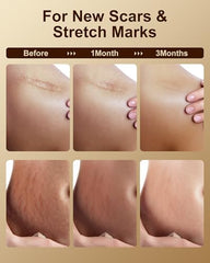 FLOWHYET vitamin E oil scar-care focus image for smoother-looking skin.