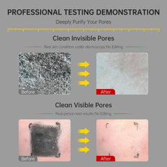 FLYLEAF Deep pore cleansing action targets impurities while preserving hydration.