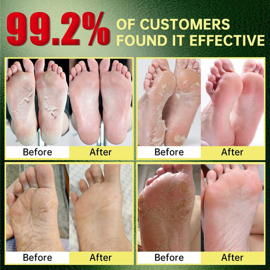 FLYLEAF Foot Peeling Mask worn on feet for gentle, painless exfoliation.