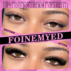 FOINEMYED soft plant-fiber band feels comfortable on lids.