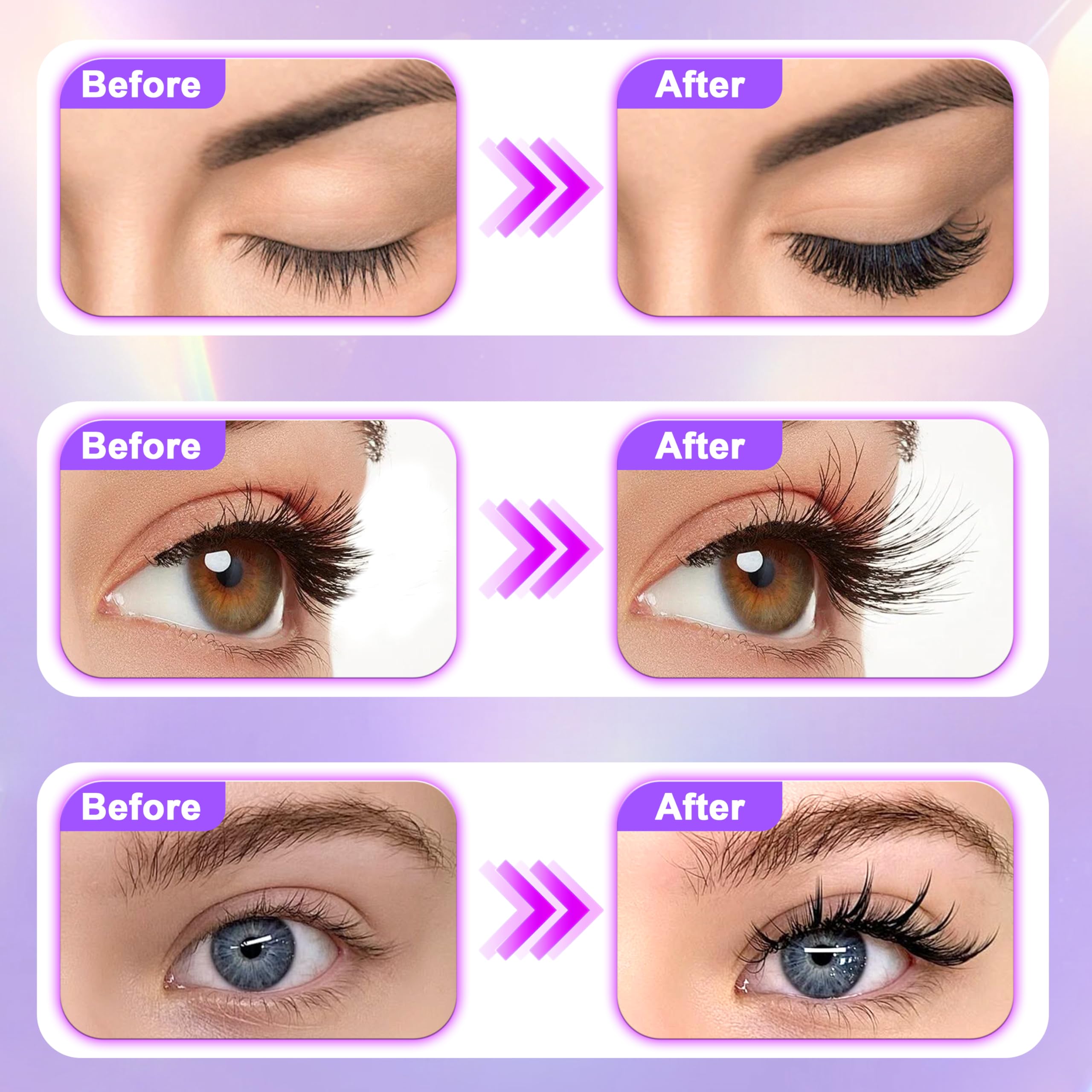 Hairline area with improved density and coverage using Folivive serum.