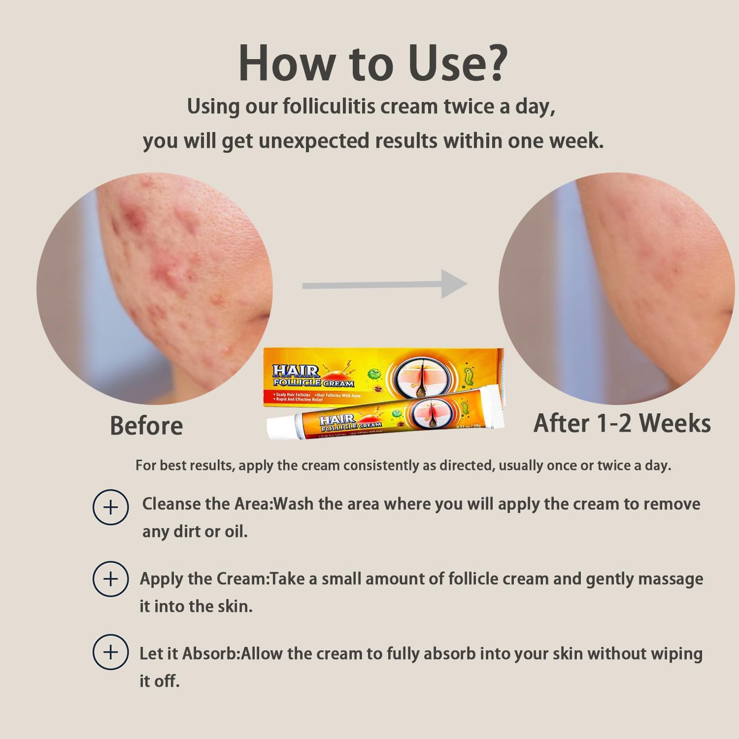 Folliculitis Cream fast absorption leaves a light, non-greasy feel for everyday use.