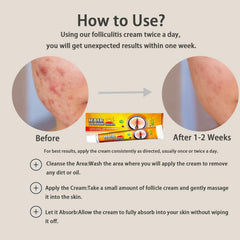 Folliculitis Cream fast absorption leaves a light, non-greasy feel for everyday use.