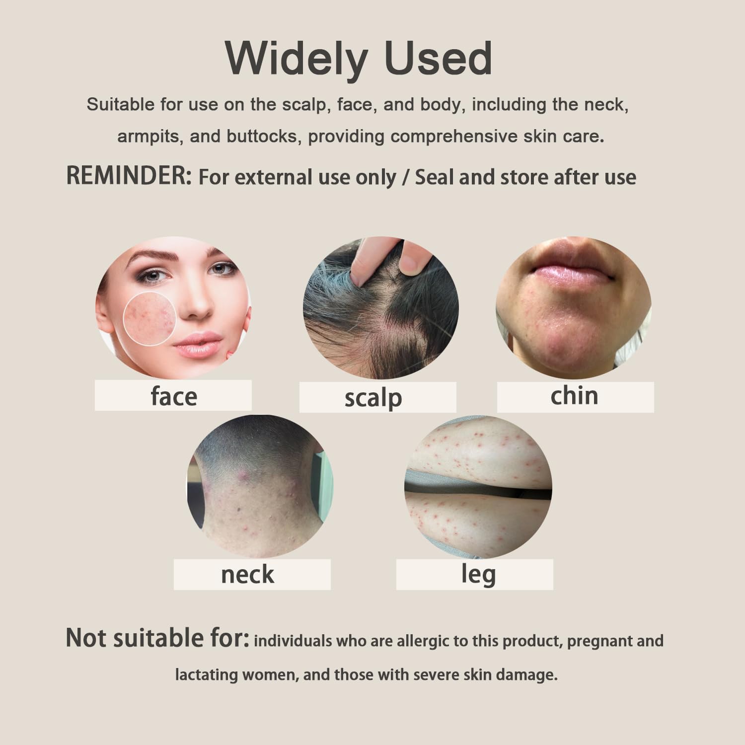 Folliculitis Cream natural ingredients promote gentle, skin-friendly care.