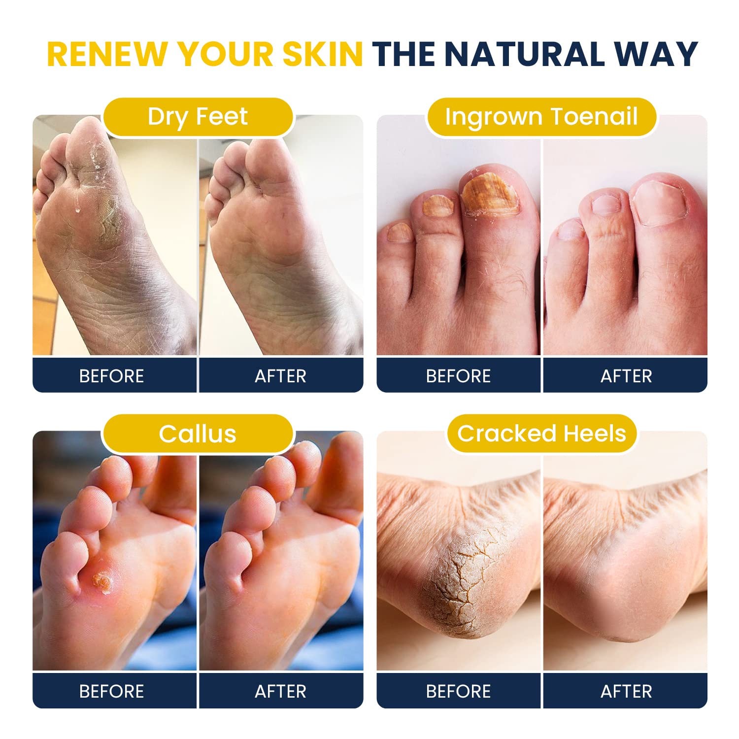 Foot Cure Citrus Detox two-pack ready for home spa use