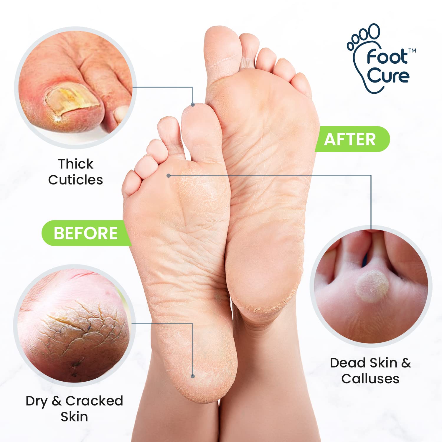 Foot Cure Epsom Salts bath blend nourishes and relaxes feet.