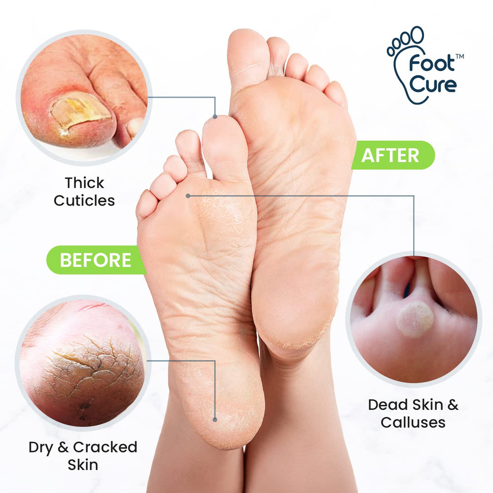 Foot Cure Epsom Salts bath blend nourishes and relaxes feet.