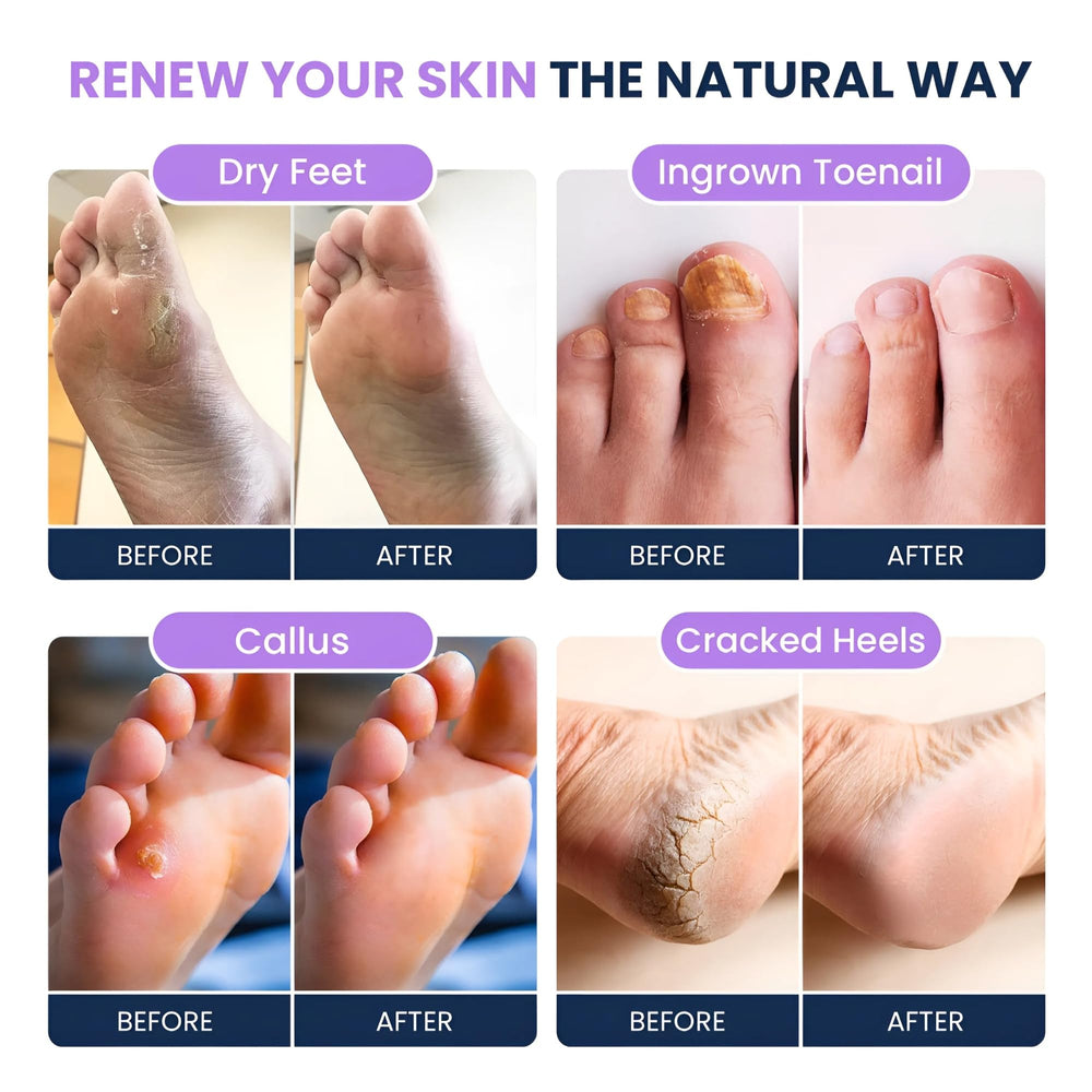 FOOT CURE spa pedicure at home for soothing foot comfort