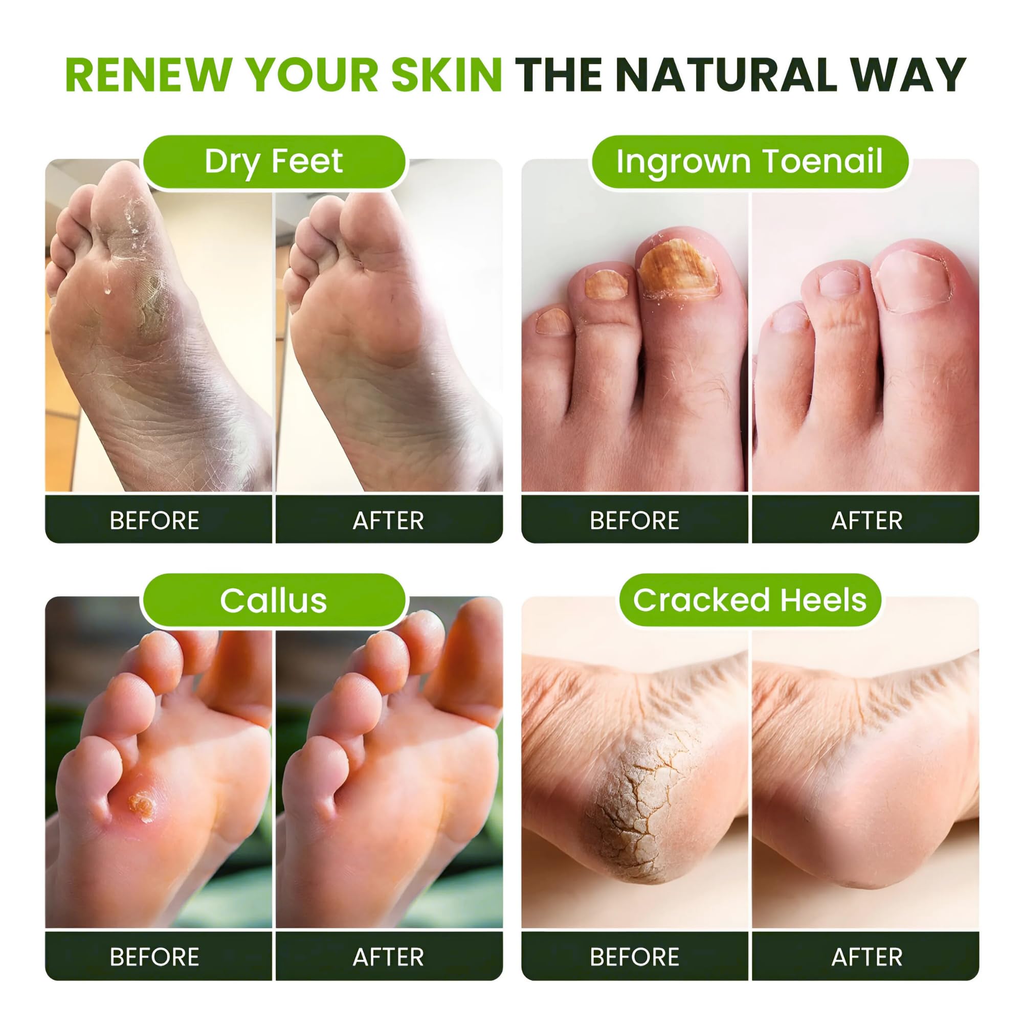 Foot Cure Tea Tree Oil Foot Soak close-up of essential oils and minerals