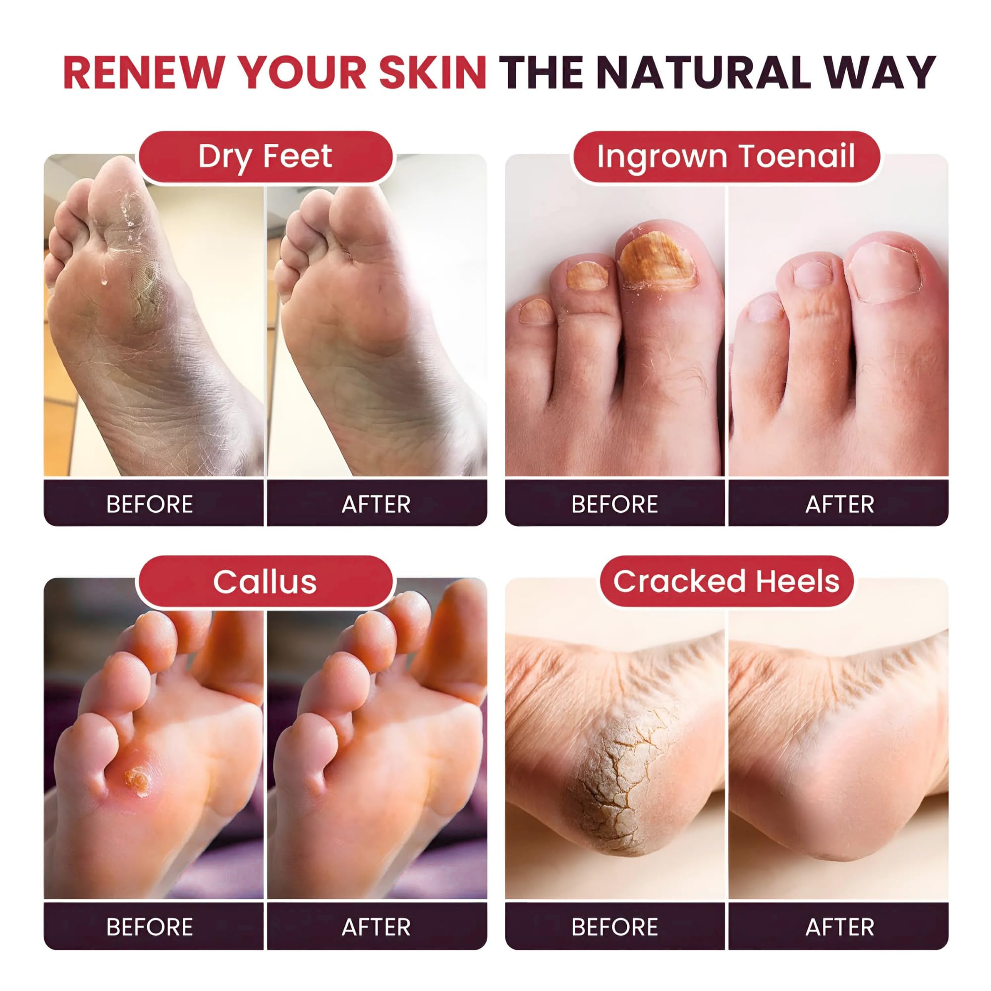FOOT CURE Tea Tree Oil Foot Soak lavender oil drop promotes calming fragrance.