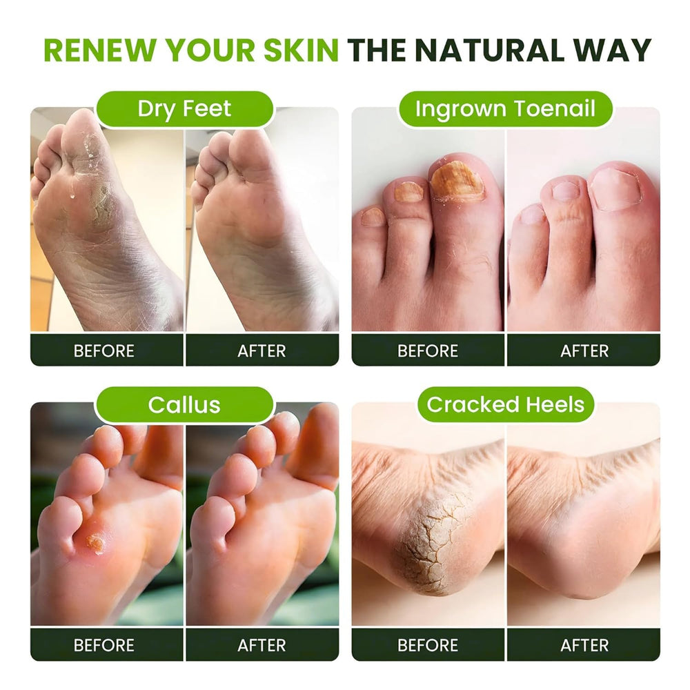 Foot Cure Tea Tree Oil Foot Soak relaxing spa-like setup for home care
