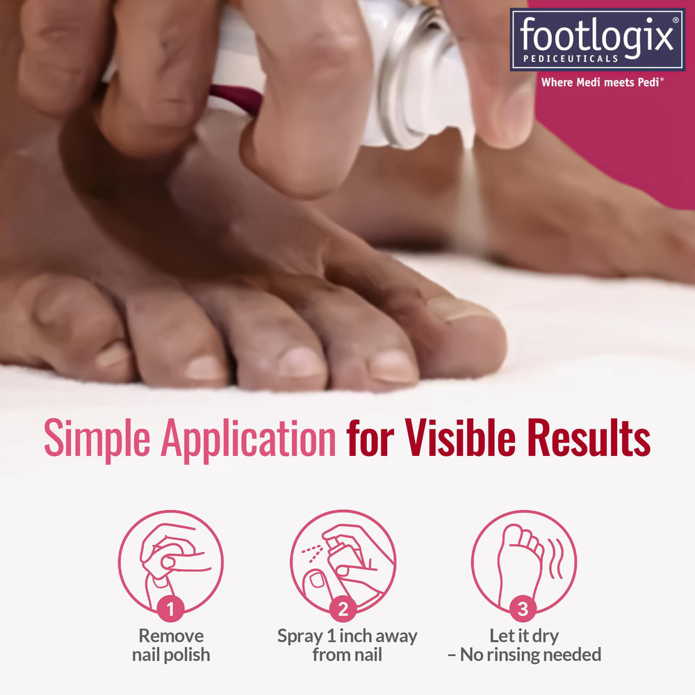 Footlogix Nail Tincture being used in daily nail care.