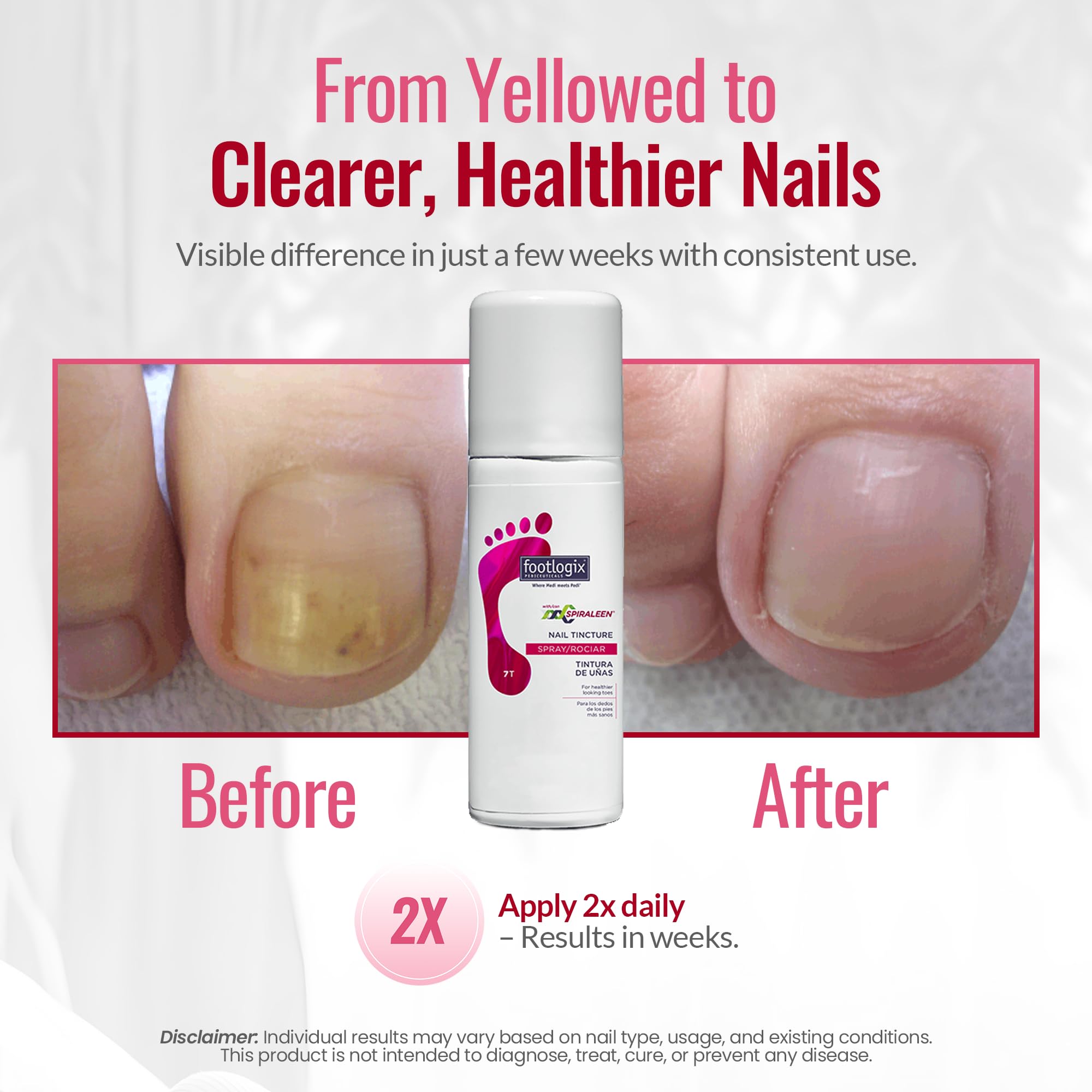 Footlogix Nail Tincture Spray packaging with Spiraleen branding.