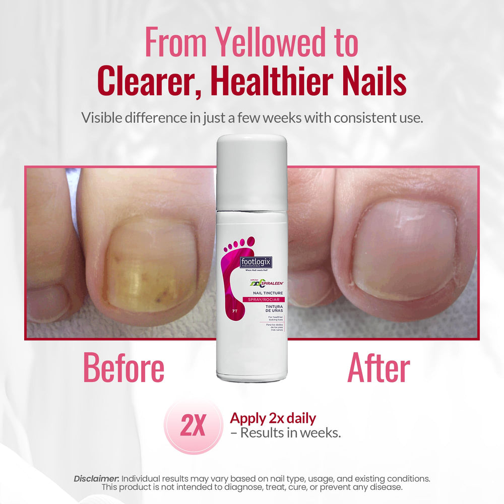 Footlogix Nail Tincture Spray packaging with Spiraleen branding.