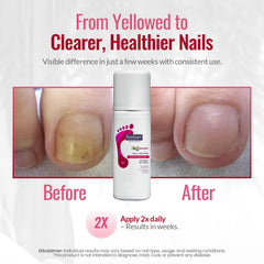 Footlogix Nail Tincture Spray packaging with Spiraleen branding.