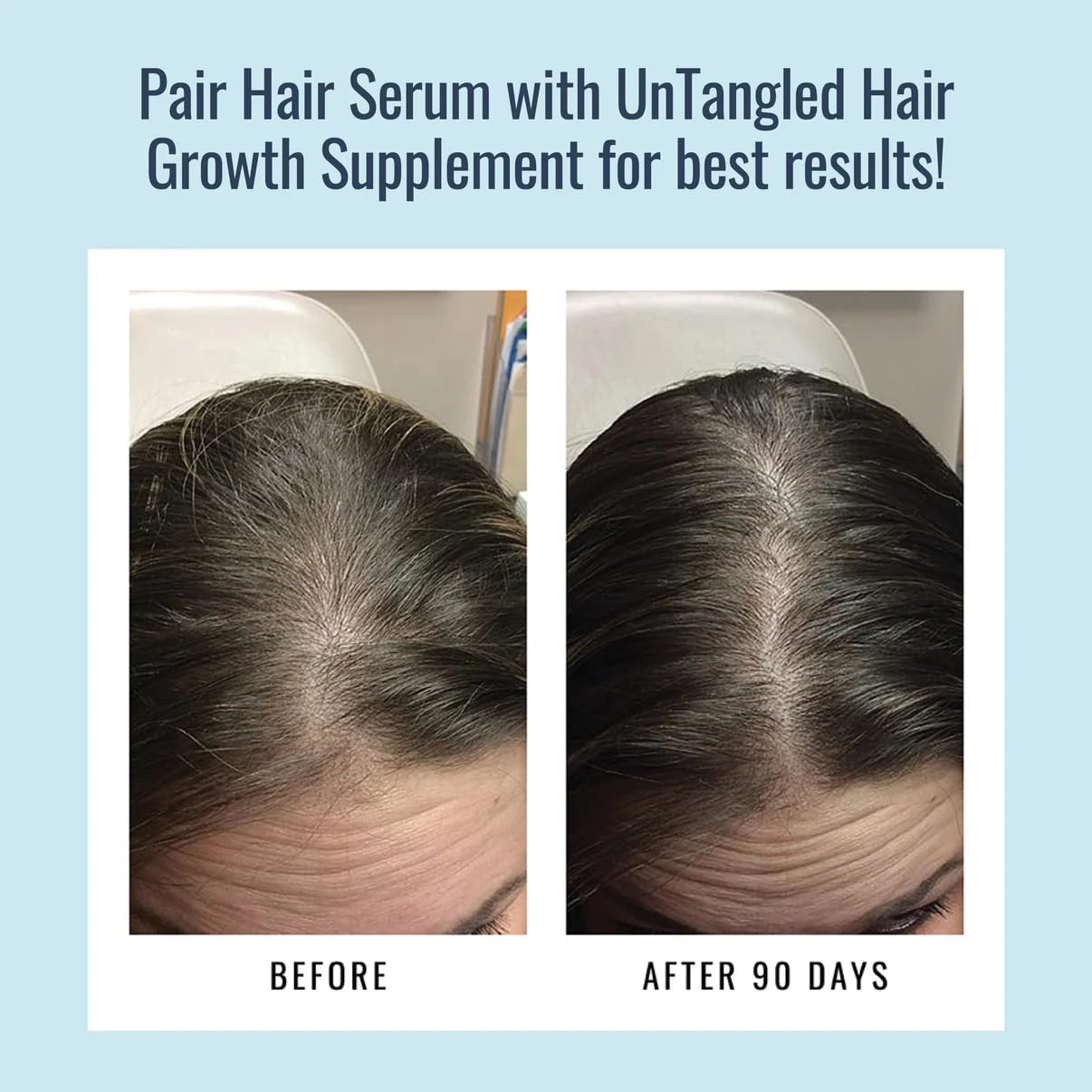 Closeup of Foundation Skincare minoxidil-free formula supporting scalp health