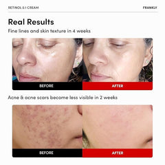 FRANKLY Retinol cream with ceramides and ginseng for hydration.