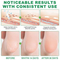 FRDUGA visible improvement in rough skin with regular use