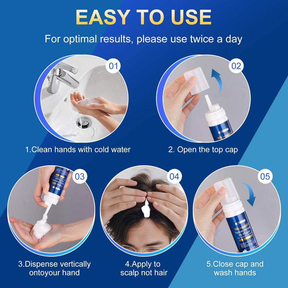 Frnoip Minoxidil Foam used on beard area for potential fullness.