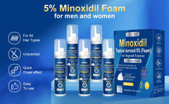 Frnoip Minoxidil Foam progress photo hinting at improvements.