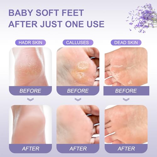 FUNNIR Foot Peeling Mask revitalized feet result with natural extracts for hydration.