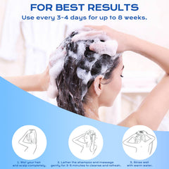 FYZMTL antifungal formula close-up illustrating scalp protection.