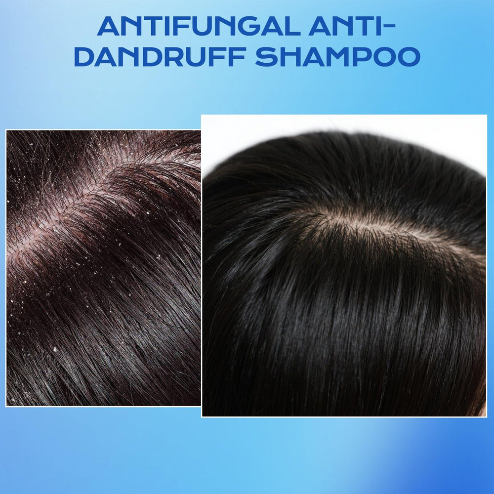 FYZMTL scalp relief closeup showing soothing application.