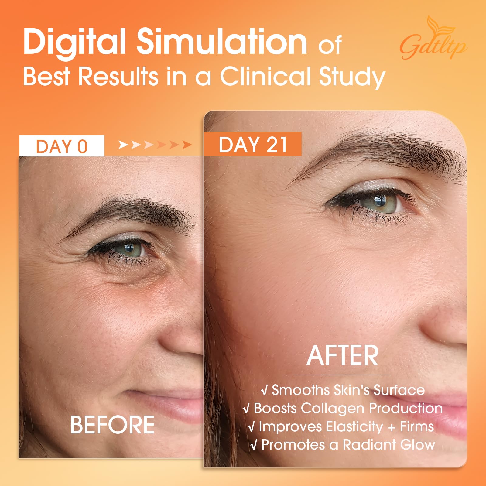 GDTLTP Salmon DNA Serum hyaluronic acid matrix for deep hydration