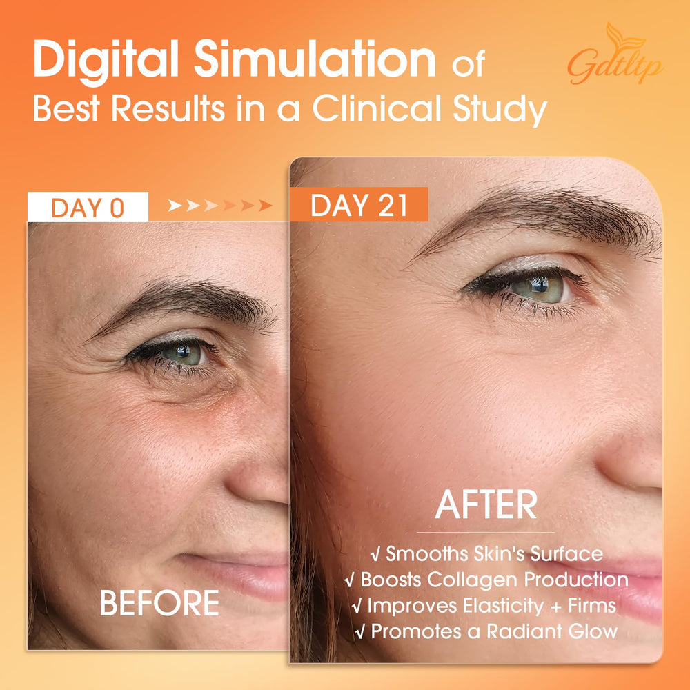 GDTLTP Salmon DNA Serum hyaluronic acid matrix for deep hydration