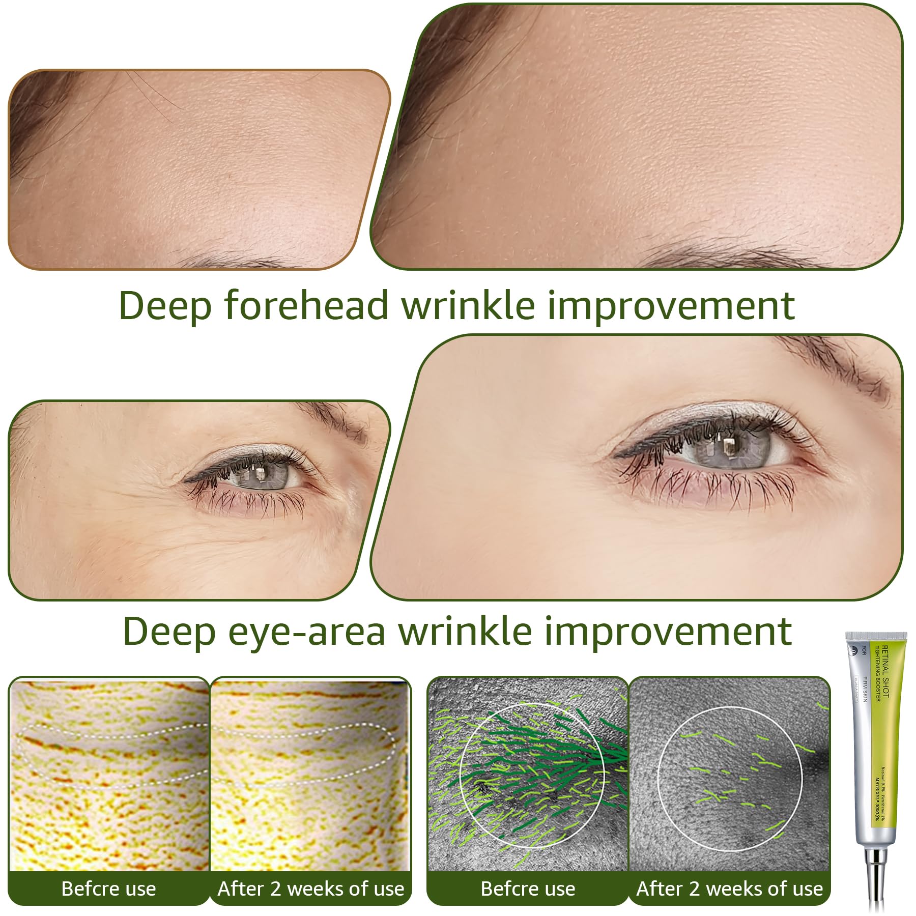 Generic Retinal Shot Tightening Liposome Graphic highlights absorption and gentle delivery.