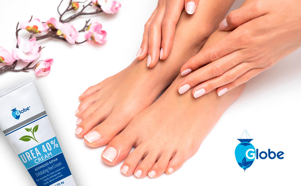 Globe Urea Cream 40% on cracked heels repairing dry skin.