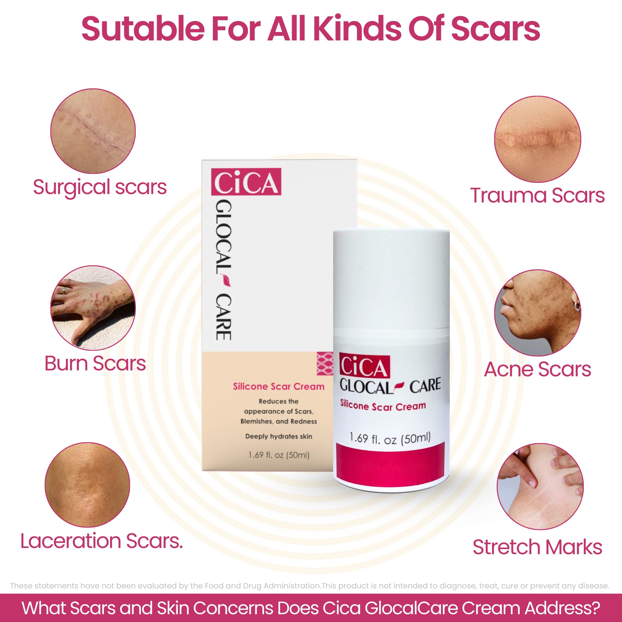 GlocalCare CICA scar cream 50 ml bottle labeled for long-term scar care.