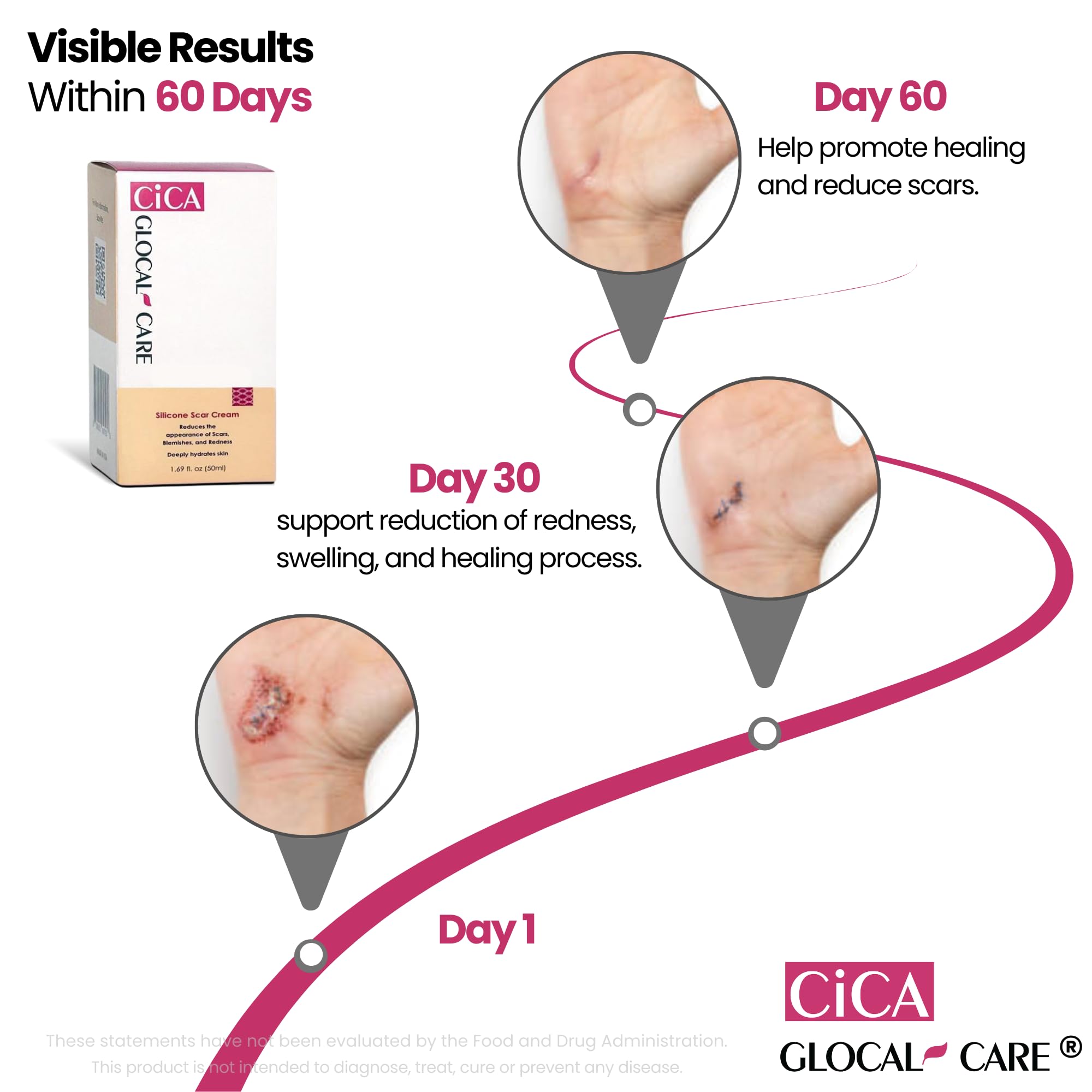 Panthenol and Niacinamide in GlocalCare CICA scar cream offer soothing care.
