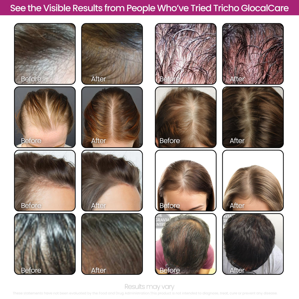 GlocalCare Tricho brow and lash density focus for cosmetic enhancement