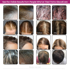GlocalCare Tricho brow and lash density focus for cosmetic enhancement