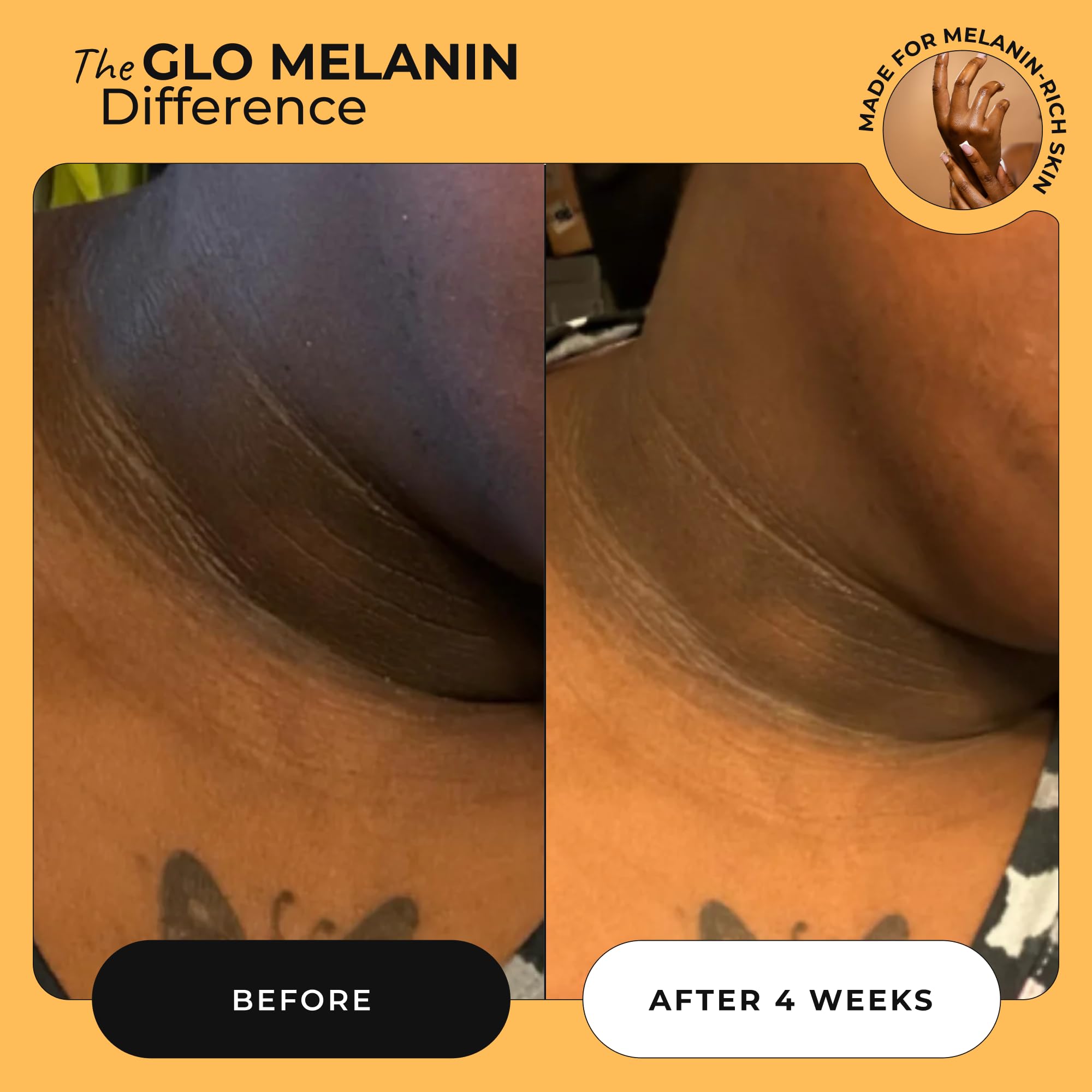 Glo Melanin underarms treatment for smoother, more uniform skin tone