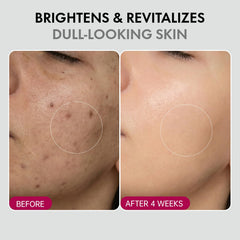 Applying Glopink cream on the face for smooth hydration