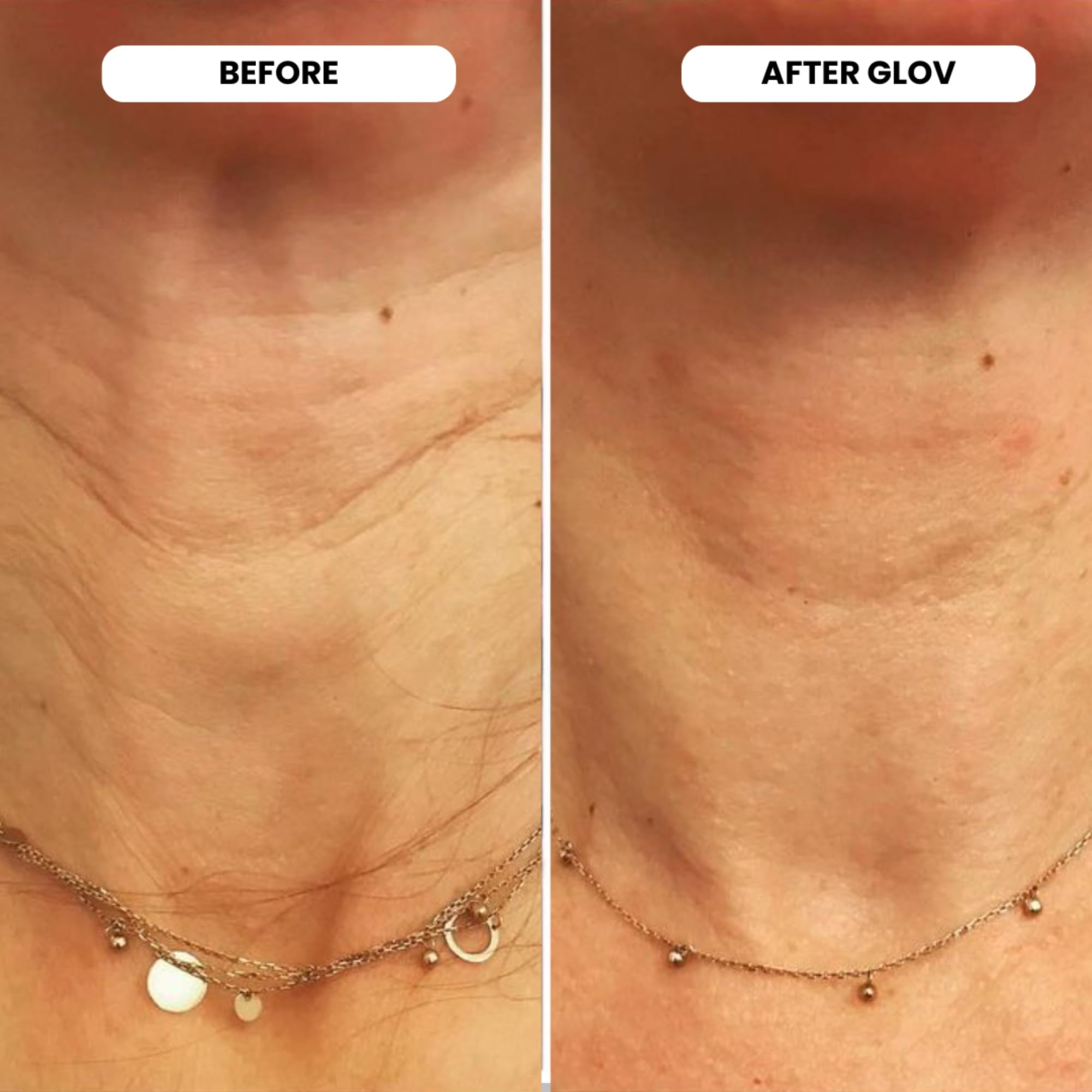 Glov Beauty hyaluronic acid serum ampoules hydrate and refresh skin.