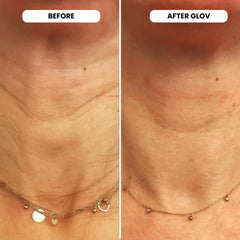 Glov Beauty hyaluronic acid serum ampoules hydrate and refresh skin.