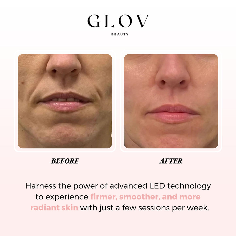 Glov Beauty LED mask user reading during therapy